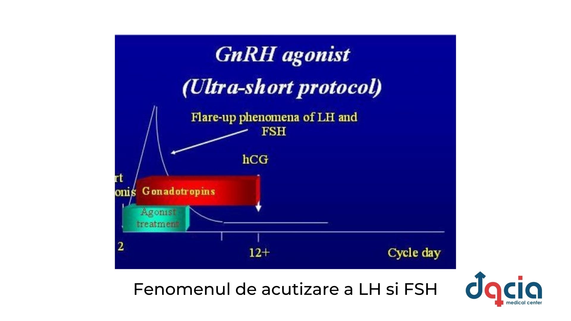 fenomenul de acutizare a LH si FSH