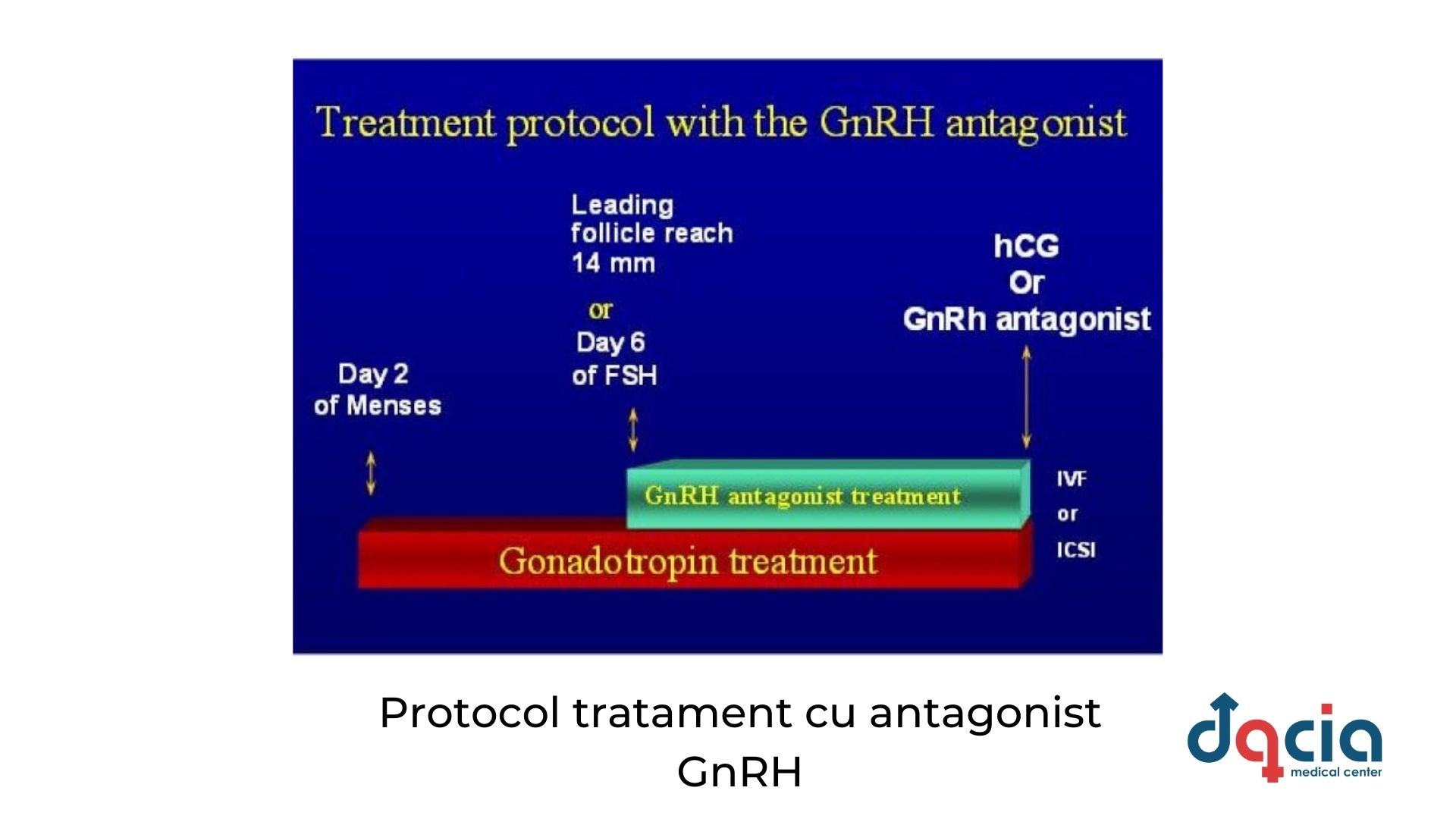 protocol de tratament cu antagonist GnRH