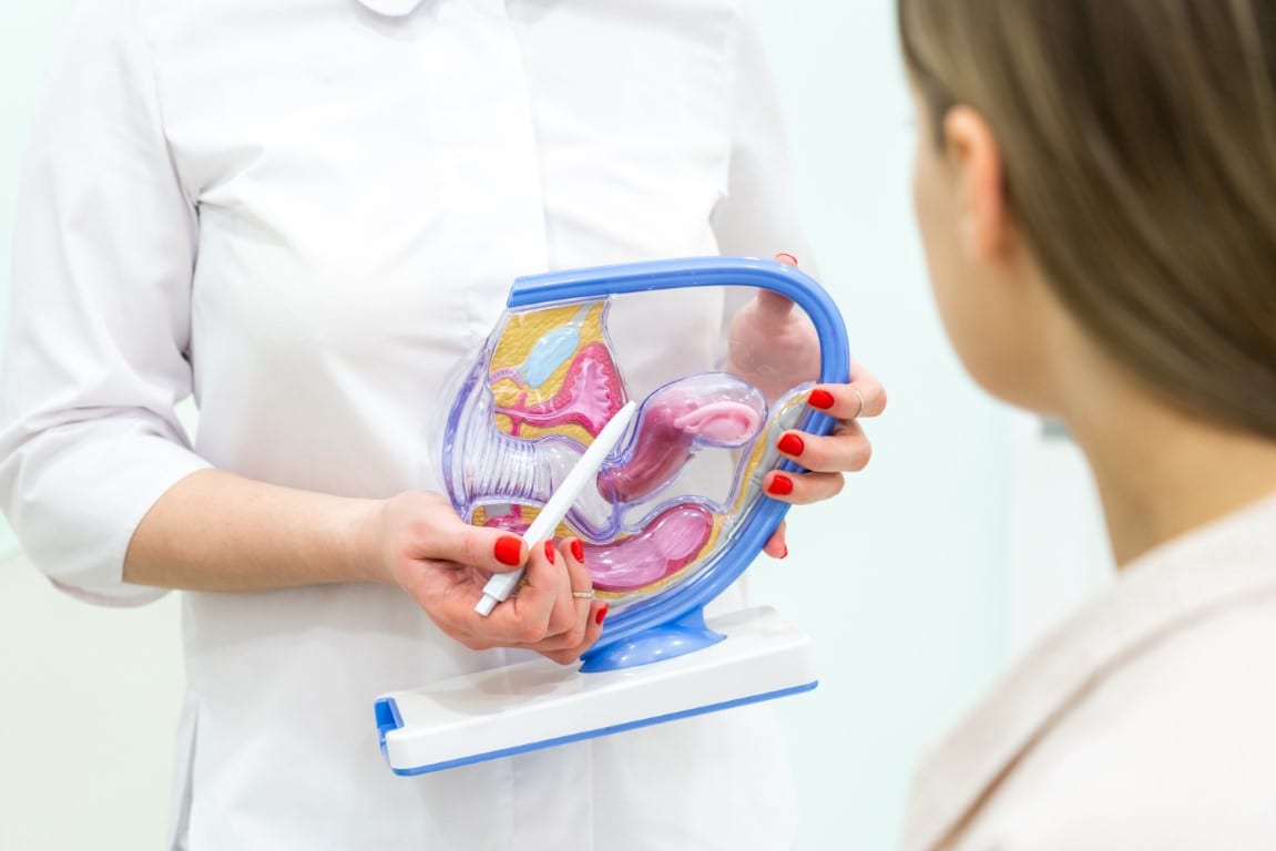 cauze ale fibromului uterin