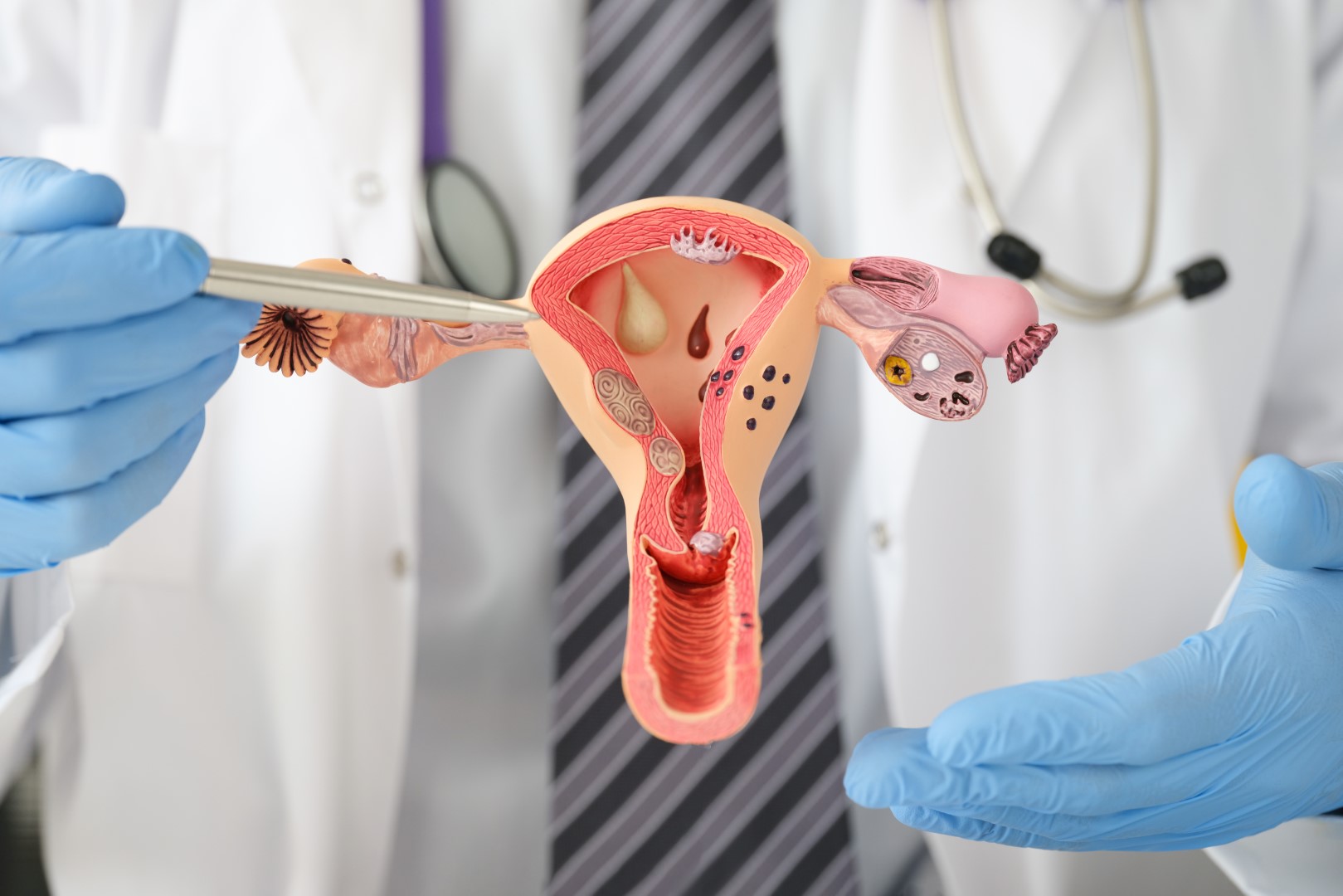 procedura legare trompe uterine