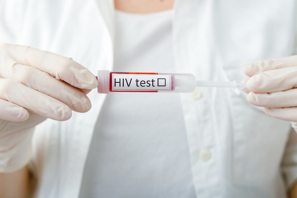 testare hiv